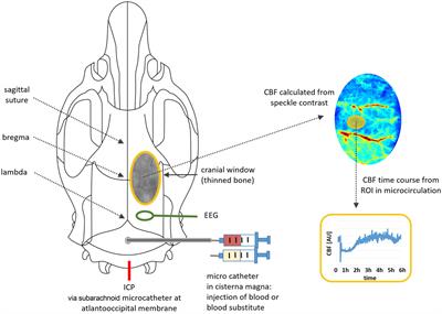 Effect of isolated intracranial hypertension on cerebral perfusion within the phase of primary disturbances after subarachnoid hemorrhage in rats